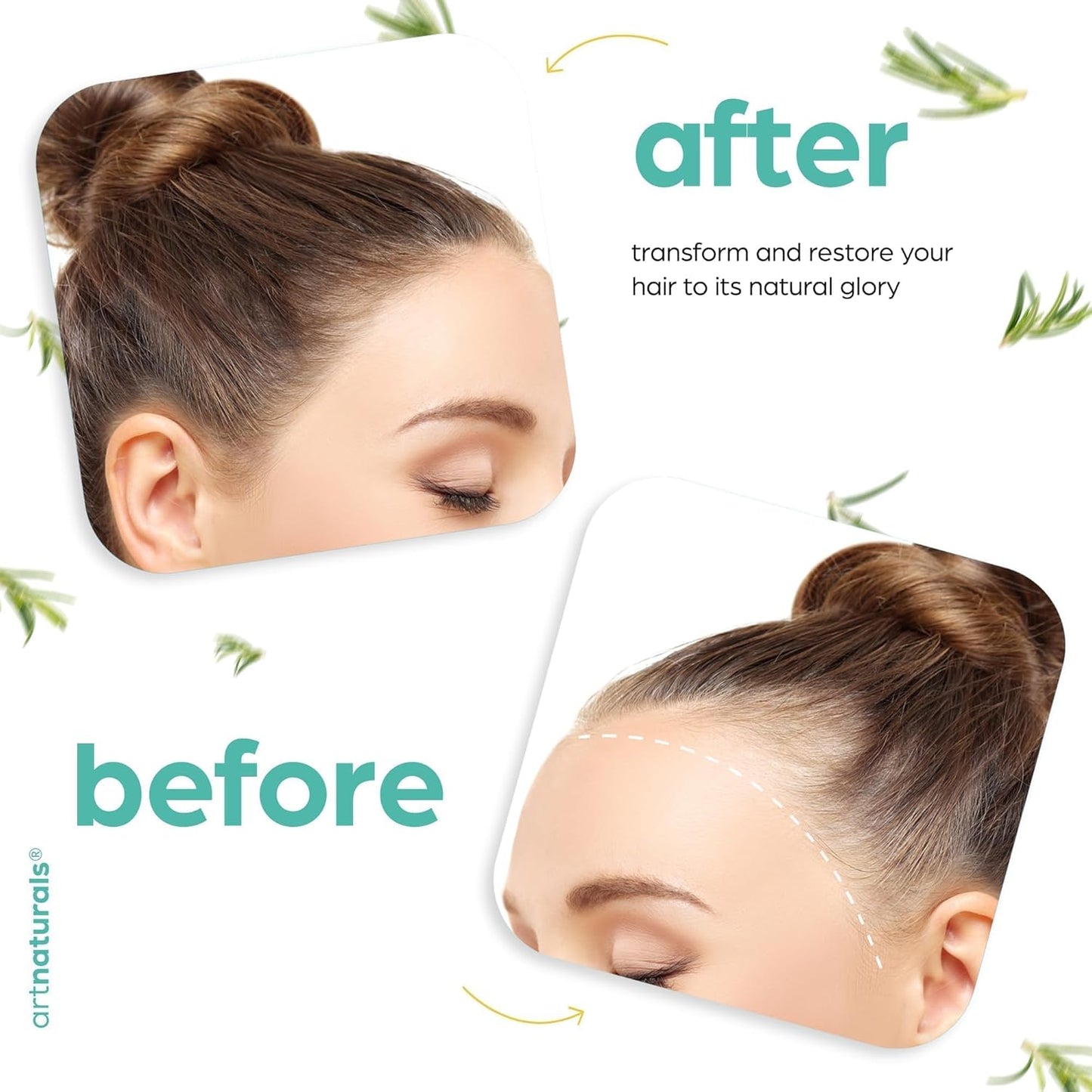 Organic Rosemary & Castor Hair Growth Oil + Scalp Massager Set – Hair Relaxer for Dry, Itchy Scalp, Thickening & Hydration - Scalp Oil Products for Damaged Hair & Split Ends – 4.0 Oz