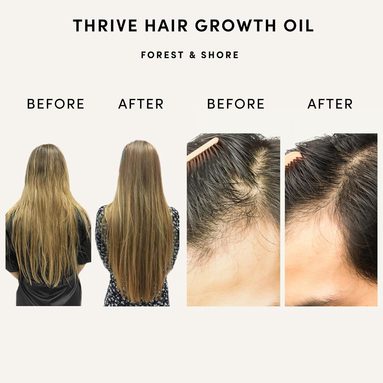 Hair Growth Oil, 100% Natural, with Caffeine, Biotin, Castor , Argan & Rosemary, Effective Serum for Damaged Hair